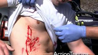 EMT Training (23) Chest Trauma by Action Training Systems