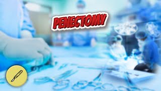 Penectomy - Everything Surgeries ✅?⁉️