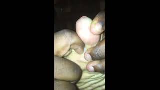 Picking my grandma toes