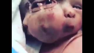 Deformed Baby is All Sorts of FUBAR   theYNC