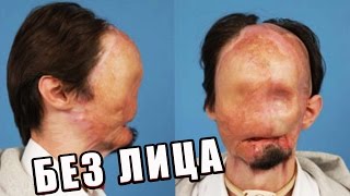 БЕЗ ЛИЦА