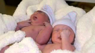 my twins (anencephaly awareness)