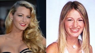 Celebs Who Rocked Bracefaces