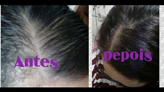COLOQUE ISSO NO SHAMPOO E VEJA O QUE ACONTECE - CABELO RALO NUNCA MAIS