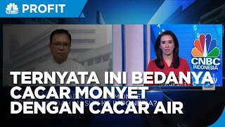 Simak! Kemenkes Ungkap Beda Gejala Cacar Monyet Dengan Cacar Air