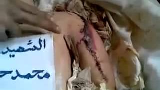 Assad Torture Kills 12 year old boy in Rastan   11 March 12