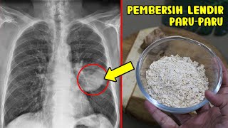 WOOW.. LENDIR & RACUN LENYAP DRI PARU-PARUMU - CARA MEMBERSIHKAN LENDIR DI TENGGOROKAN DAN PARU PARU