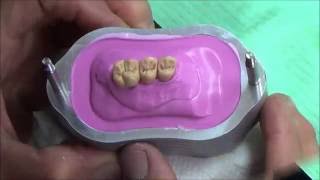Composito BioXfill
