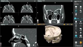 DICOM Viewer—Medical Image Manipulation