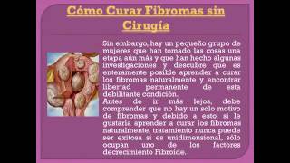 Cómo Curar Fibromas sin Cirugía