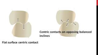 Occlusal adjustment-Terms and definitions