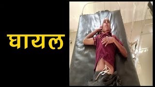 बोलेरो के धक्के से 10 वर्षीय बच्चा हुआ घायल