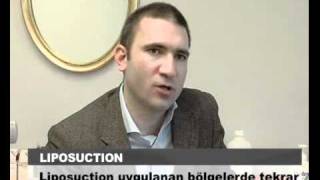 Yağ Aldırma Ameliyatı Sonrasında Tekrar Yağlanma Olur Mu ?