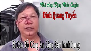 Đinh Quang Tuyến bị côn đồ công an cộng sản hành hung