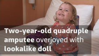 Two-year-old amputee overjoyed with lookalike doll