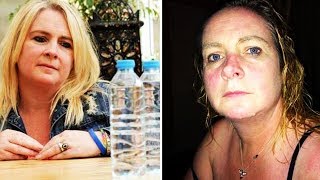 Die 6 schlimmsten Allergien die dein Leben für immer verändern!