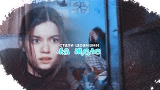 ДЕТИ СЕСТЕР__стали шрамами на теле (+400)
