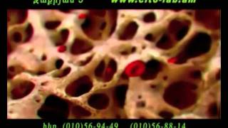 Cito-Lab Armenia_Part 2