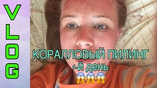 Коралловый пилинг - первый день * Припухла малость