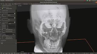 [ OrtogOnBlender ] - Import, view, edit and export DICOM!