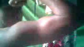 bycep