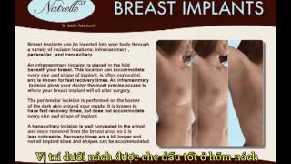 Natrelle Breast Implants