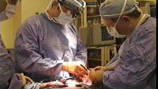 MY INTESTINES! Yes, watch in horror as my bowels are cut open!