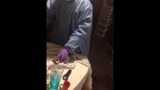 Old Root tree county woman autopsy area 52 part 1