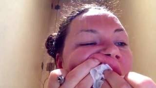 Essential DIY Dental abscess draining...