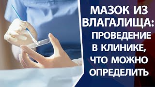 Мазок из влагалища