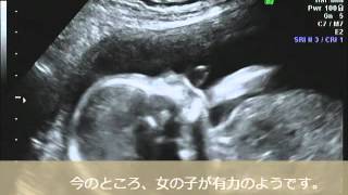 ６ヶ月妊婦健診（20w）