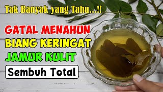 ORANG JAMAN NOW SUDAH TAHU? GATAL MENAHUN, BIANG KERINGAT, JAMUR KULIT SEMBUH SEKETIKA || SEHAT TUBE