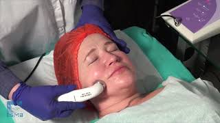 The procedure phonophoresis - Esma 12.05 Ultrasound