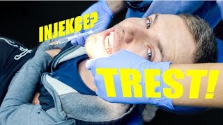 TREST ZA PROHRANOU CHALLENGE - ZUBAŘ?