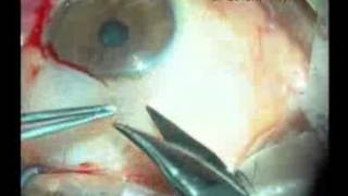 Piterjimun - Op.Dr.Levent Akçay
