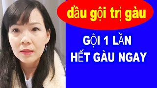 DẦU GỘI TRỊ GÀU selsun blue, trị gàu tốt nhất - DẦU GỘI ĐẦU KHÔ ( dry shampoo) #23