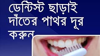 ডেন্টিস্ট ছাড়াই দাতের পাথর দূর করার উপায়