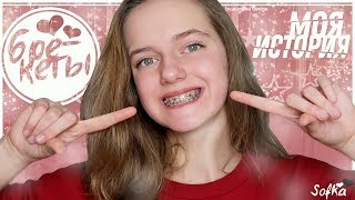 БРЕКЕТЫ / МОЯ ИСТОРИЯ