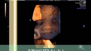 7ヶ月妊婦健診（26w）4D