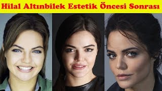 Bir Zamanlar Çukurova Oyuncularının Şok Eden Eski Halleri