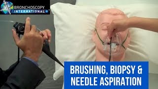 Bronchoscopy Step by Step Techniques 2