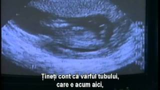 The Silent Scream | Strigătul mut (Romanian subtitles)
