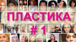 Когда делать операцию? Жертвы пластической хирургии #1