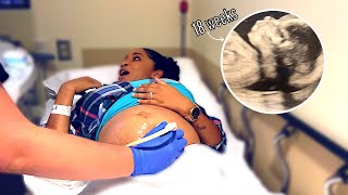 GENDER SCAN AT 18 WEEKS: BOY or GIRL?! | MOM VLOG · VICTORIA VADEN