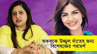 ঝকঝকে দাঁত চান, জেনে নিন | Dental Whitening Treatment | Goodie Life
