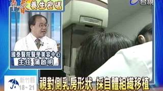 乳癌年輕化術後乳房重建拾信心
