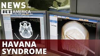 Pentagon to allocate funds for 'Havana syndrome' victims