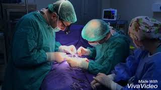 Xayalıq forma Hipospadiya. Scrotal Hypospadias repair. racka technique