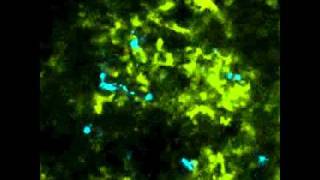 Dead Scientist Ralph Steinman Wins Nobel prize discovered immune system cells