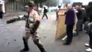 Одесситу отрубают ногу